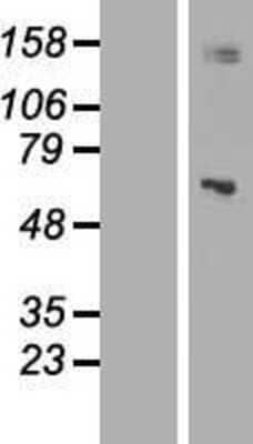 Western Blot: Mitochondrial ribonuclease P protein 3 Overexpression Lysate (Adult Normal) [NBL1-12244] Left-Empty vector transfected control cell lysate (HEK293 cell lysate); Right -Over-expression Lysate for Mitochondrial ribonuclease P protein 3.