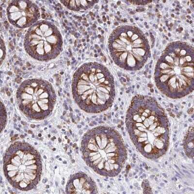 Immunohistochemistry-Paraffin: Mitochondrial ribosomal protein L11 Antibody [NBP2-33844] - Staining of human colon shows strong cytoplasmic positivity in glandular cells.
