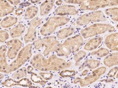 Immunohistochemistry-Paraffin: Mitochondrial ribosomal protein L11 Antibody [NBP3-06019] - Immunochemical staining of human MRPL11 in human kidney with rabbit polyclonal antibody at 1:100 dilution, formalin-fixed paraffin embedded sections.