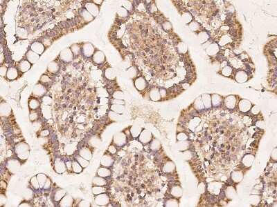 Immunohistochemistry-Paraffin: Mitochondrial ribosomal protein L11 Antibody [NBP3-06019] - Immunochemical staining of human MRPL11 in human small intestine with rabbit polyclonal antibody at 1:100 dilution, formalin-fixed paraffin embedded sections.