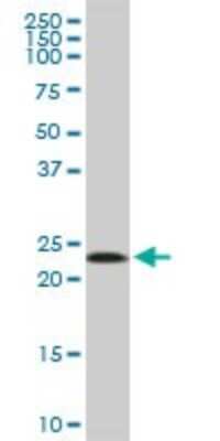 Western Blot: Mitochondrial ribosomal protein L11 Antibody [H00065003-B01P] - Analysis of MRPL11 expression in A-431.