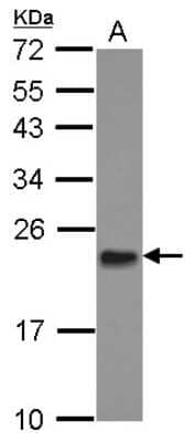 Western Blot: Mitochondrial ribosomal protein L11 Antibody [NBP2-17296] - Sample (30 ug of whole cell lysate) A: A431 12% SDS PAGE gel, diluted at 1:1000.