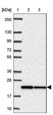 Western Blot: Mitochondrial ribosomal protein L11 Antibody [NBP2-33844] - Lane 1: Marker  [kDa] 250, 130, 95, 72, 55, 36, 28, 17, 10.  Lane 2: Human cell line RT-4.  Lane 3: Human cell line U-251MG sp
