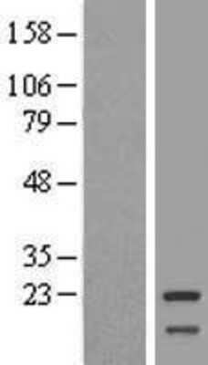 Western Blot: Mitochondrial ribosomal protein L11 Overexpression Lysate (Adult Normal) [NBL1-13234] Left-Empty vector transfected control cell lysate (HEK293 cell lysate); Right -Over-expression Lysate for Mitochondrial ribosomal protein L11.