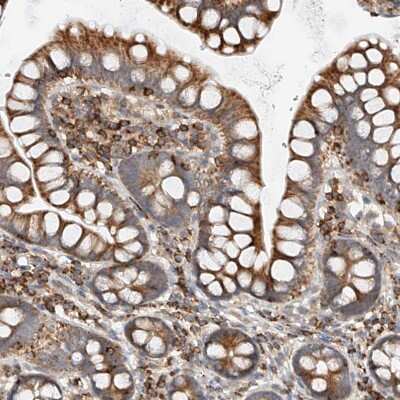 Immunohistochemistry-Paraffin: Mitofusin 2 Antibody [NBP1-85477] - Staining of human small intestine shows strong positivity in lymphoid cells.