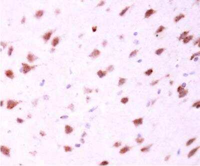 Immunohistochemistry-Paraffin: Mitofusin 2 Antibody [NBP2-17298] - Paraffin-embedded mouse fore brain. MFN2 antibody [N1N2], N-term dilution: 1:500.