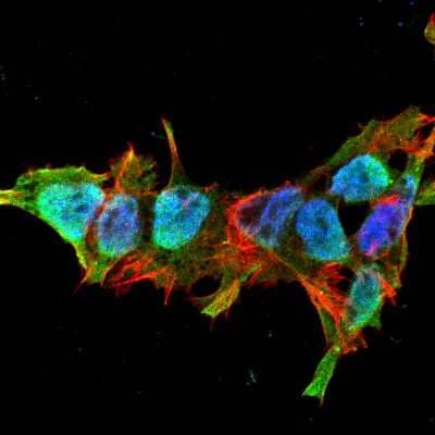 Immunocytochemistry/Immunofluorescence: Mitofusin 2 Antibody (S153-5) [NBP2-42188] - Tissue: Neuroblastoma cell line SK-N-BE. Species: Human. Fixation: 4% Formaldehyde for 15 min at RT. Primary Antibody: Mouse Anti-Mitofusin 2 Monoclonal Antibody at 1:100 for 60 min at RT. Secondary Antibody: Goat Anti-Mouse ATTO 488 at 1:100 for 60 min at RT. Counterstain: Phalloidin Texas Red F-Actin stain; DAPI (blue) nuclear stain at 1:1000; 1:5000 for 60 min RT, 5 min RT. Localization: Cytoplasm, Nucleus. Magnification: 60X.