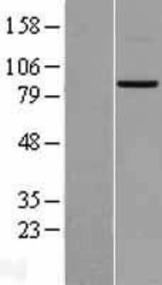 Western Blot: Mitofusin-2 Overexpression Lysate (Adult Normal) [NBL1-13040] Left-Empty vector transfected control cell lysate (HEK293 cell lysate); Right -Over-expression Lysate for Mitofusin-2.