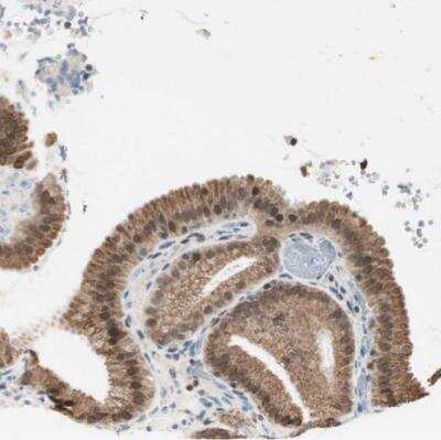 Immunohistochemistry-Paraffin: Miz-1/ZBTB17 Antibody [NBP1-81048] - Staining of human gallbladder shows moderate cytoplasmic and nuclear positivity in glandular cells.