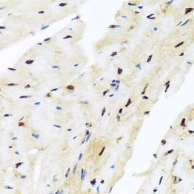 Immunohistochemistry-Paraffin: Miz-1/ZBTB17 Antibody [NBP3-03358] - Mouse heart using Miz-1/ZBTB17 antibody at dilution of 1:100 (40x lens).