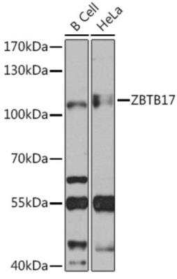 Western Blot: Miz-1/ZBTB17 Antibody [NBP3-03357] - Western blot analysis of extracts of various cell lines, using Miz-1/ZBTB17 antibody at 1:1000 dilution. Secondary antibody: HRP Goat Anti-Rabbit IgG (H+L) at 1:10000 dilution. Lysates/proteins: 25ug per lane. Blocking buffer: 3% nonfat dry milk in TBST.Detection: ECL Basic Kit. Exposure time: 30s.