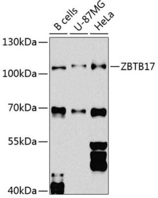 Western Blot: Miz-1/ZBTB17 Antibody [NBP3-03358] - Analysis of extracts of various cell lines, using Miz-1/ZBTB17 antibody at 1:1000 dilution. Secondary antibody: HRP Goat Anti-Rabbit IgG (H+L) at 1:10000 dilution. Lysates/proteins: 25ug per lane. Blocking buffer: 3% nonfat dry milk in TBST.