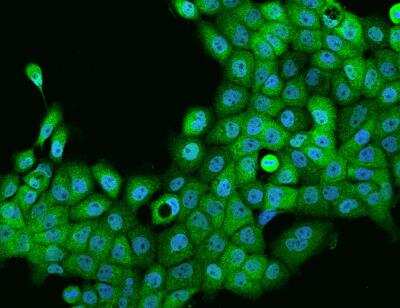 Immunocytochemistry/Immunofluorescence: Mkl1 Antibody [NBP3-06006] - Staining of MKL1 in A431 cells. Cells were fixed with 4% PFA, permeabilzed with 0.1% Triton X-100 in PBS,blocked with 10% serum, and incubated with rabbit anti-Human MKL1 polyclonal antibody (dilution ratio 1:200) at 4 degrees celsius overnight. Then cells were stained with the Alexa Fluor (TM) 488-conjugated Goat Anti-rabbit IgG secondary antibody (green) and counterstained with DAPI (blue).Positive staining was localized to Nucleus and Cytoplasm.