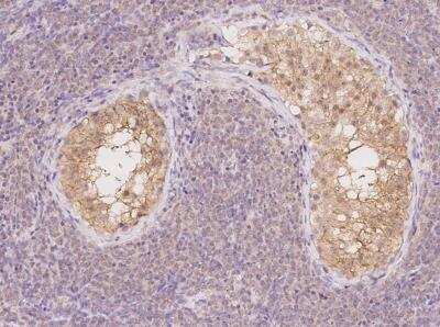 Immunohistochemistry-Paraffin: Mkl1 Antibody [NBP3-06006] - Staining of human MKL1 in human testis with rabbit polyclonal antibody at 1:200 dilution.