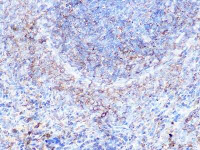 Immunohistochemistry-Paraffin: Moesin Antibody (6G0N7) [NBP3-16513] - Immunohistochemistry of paraffin-embedded rat spleen using Moesin Rabbit mAb (NBP3-16513) at dilution of 1:100 (40x lens).Perform microwave antigen retrieval with 10 mM PBS buffer pH 7.2 before commencing with IHC staining protocol.