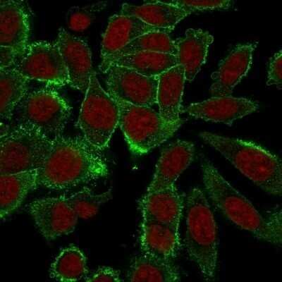 Immunocytochemistry/Immunofluorescence: Moesin Antibody (MSN/492) - Azide and BSA Free [NBP2-47916] - Immunofluorescent staining of paraformaldehyde-fixed HeLa cells. Moesin Antibody (MSN/492) followed by goat anti-Mouse IgG-CF488 (Green). The nuclear counterstain is Red Dot (Red)