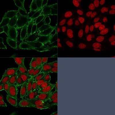 Immunocytochemistry/Immunofluorescence: Moesin Antibody (MSN/493) - Azide and BSA Free [NBP2-47917] - Immunofluorescent staining of paraformaldehyde-fixed HeLa cells. Moesin Antibody (MSN/493) followed by goat anti-Mouse IgG-CF488 (Green). The nuclear counterstain is Red Dot (Red)