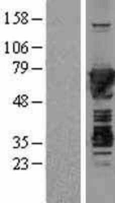 Western Blot Moesin Overexpression Lysate