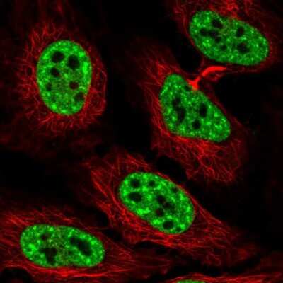 Immunocytochemistry/Immunofluorescence: Mohawk homeobox Antibody [NBP1-89912] - Staining of human cell line HeLa shows localization to nuclear speckles. Antibody staining is shown in green.