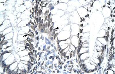 Immunohistochemistry Mohawk homeobox Antibody - BSA Free