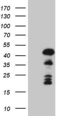 Western Blot: Mohawk homeobox Antibody (OTI6B12) - Azide and BSA Free [NBP2-72758] - Analysis of HEK293T cells were transfected with the pCMV6-ENTRY control (Left lane) or pCMV6-ENTRY Mohawk homeobox.