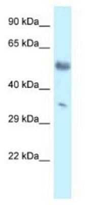 Western Blot Mohawk homeobox Antibody - BSA Free