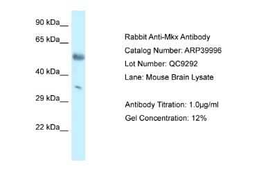 Western Blot: Mohawk homeobox Antibody [NBP1-82408] - WB Suggested Anti-Mkx Antibody. Titration: 1.0 ug/ml. Positive Control: Mouse Brain