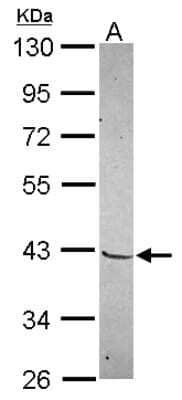 Western Blot: Mohawk homeobox Antibody [NBP2-19378] - Sample (30 ug of whole cell lysate) A: IMR32 10% SDS PAGE gel, diluted at 1:1000.