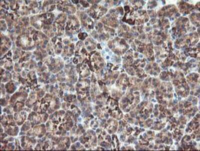 Immunohistochemistry-Paraffin: Monoamine Oxidase A Antibody (1D6) [NBP2-01751] - Staining of paraffin-embedded Human pancreas tissue using anti-Monoamine Oxidase A mouse monoclonal antibody.