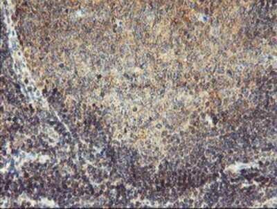 Immunohistochemistry-Paraffin: Monoamine Oxidase A Antibody (1D6) [NBP2-01751] Staining of paraffin-embedded Human tonsil using anti-Monoamine Oxidase A mouse monoclonal antibody.