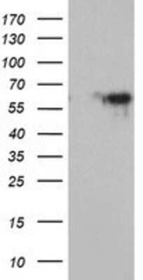 Western Blot: Monoamine Oxidase A Antibody (1D6) [NBP2-01751] - HEK293T cells were transfected with the pCMV6-ENTRY control (Left lane) or pCMV6-ENTRY Monoamine Oxidase A (Right lane) cDNA for 48 hrs and lysed. Equivalent amounts of cell lysates (5 ug per lane) were separated by SDS-PAGE and immunoblotted with anti-Monoamine Oxidase A.