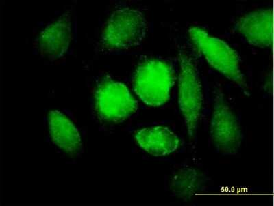 Immunocytochemistry/Immunofluorescence: Monoamine Oxidase B Antibody [H00004129-B01P] - Analysis of purified antibody to MAOB on HeLa cell. (antibody concentration 10 ug/ml)