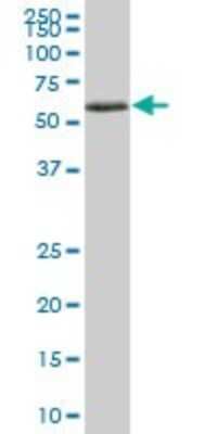 Western Blot: Monoamine Oxidase B Antibody [H00004129-B01P] - Analysis of MAOB expression in human liver.
