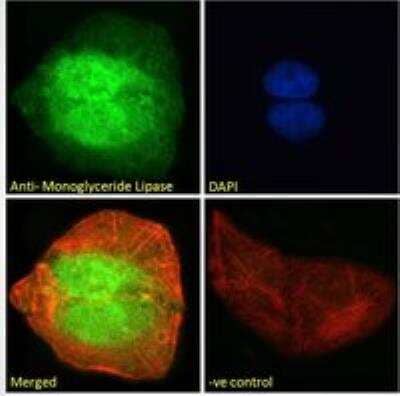 Immunocytochemistry/Immunofluorescence: Monoglyceride Lipase Antibody [NB100-96920] - Immunofluorescence analysis of paraformaldehyde fixed U2OS cells, permeabilized with 0.15% Triton. Primary incubation 1hr (10 ug/mL) followed by Alexa Fluor 488 secondary antibody (2 ug/mL), showing nuclear and cytoplasmic staining. Actin filaments were stained with phalloidin (red) and the nuclear stain is DAPI (blue). Negative control: Unimmunized goat IgG (10 ug/mL) followed by Alexa Fluor 488 secondary antibody (2 ug/mL).