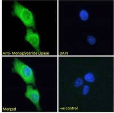 Immunocytochemistry/Immunofluorescence: Monoglyceride Lipase Antibody [NB100-96920] - Immunofluorescence analysis of paraformaldehyde fixed A431 cells, permeabilized with 0.15% Triton. Primary incubation 1hr (10 ug/mL) followed by Alexa Fluor 488 secondary antibody (2 ug/mL), showing cytoplasmic and endoplasmic reticulum staining. The nuclear stain is DAPI (blue). Negative control: Unimmunized goat IgG (10 ug/mL) followed by Alexa Fluor 488 secondary antibody (2 ug/mL).