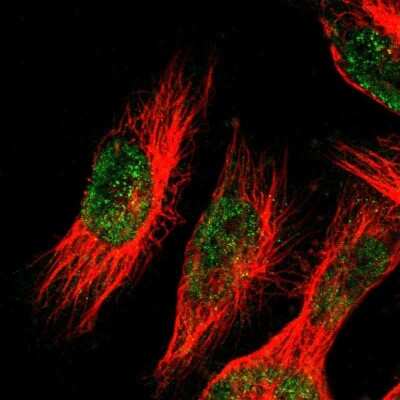 Immunocytochemistry/Immunofluorescence: Monoglyceride Lipase Antibody [NBP1-89645] - Staining of human cell line U-251 MG shows localization to nucleoplasm. Antibody staining is shown in green.
