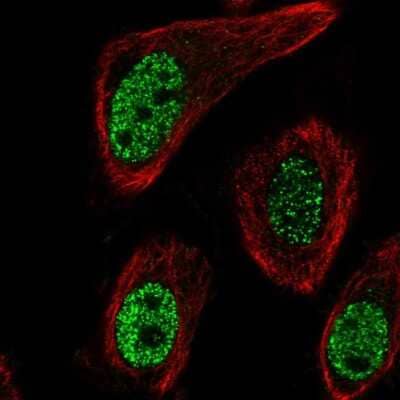 Immunocytochemistry/Immunofluorescence: Monoglyceride Lipase Antibody [NBP2-55204] - Staining of human cell line PC-3 shows localization to nucleoplasm. Antibody staining is shown in green.