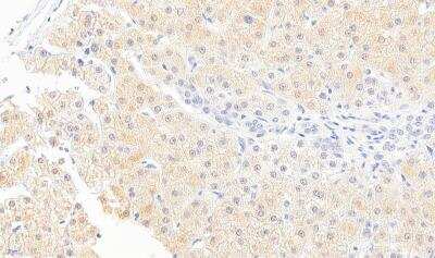 Immunohistochemistry-Paraffin: Monoglyceride Lipase Antibody [NB100-96920] - Staining of paraffin embedded Human Liver. Antibody at 5 ug/mL. Heat induced antigen retrieval with citrate buffer pH 6, HRP-staining.