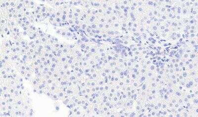 Immunohistochemistry-Paraffin: Monoglyceride Lipase Antibody [NB100-96920] - Negative Control showing staining of paraffin embedded Human Liver, with no primary antibody.