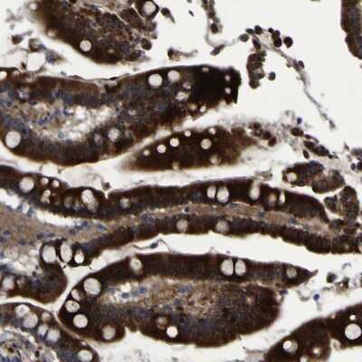 Immunohistochemistry-Paraffin: Monoglyceride Lipase Antibody [NBP1-89645] - Staining of human colon shows strong cytoplasmic positivity in glandular cells.