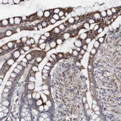 Immunohistochemistry-Paraffin: Monoglyceride Lipase Antibody [NBP1-89646] - Staining of human colon shows cytoplasmic positivity in glandular cells.