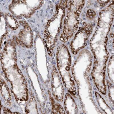 Immunohistochemistry-Paraffin: Monoglyceride Lipase Antibody [NBP1-89646] - Staining of human kidney shows cytoplasmic positivity in cells in tubules.