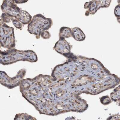 Immunohistochemistry-Paraffin: Monoglyceride Lipase Antibody [NBP1-89646] - Staining of human placenta shows cytoplasmic positivity in trophoblastic cells.