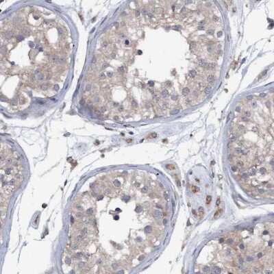 Immunohistochemistry-Paraffin: Monoglyceride Lipase Antibody [NBP1-89646] - Staining of human testis shows cytoplasmic positivity in cells in seminiferous ducts and Leydig cells.