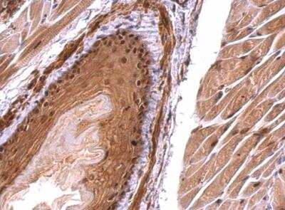 Immunohistochemistry-Paraffin: Monoglyceride Lipase Antibody [NBP2-19380] -   Mouse esophagus. Monoglyceride lipase antibody dilution: 1:500. Antigen Retrieval: Trilogy™ (EDTA based, pH 8.0) buffer, 15min. 