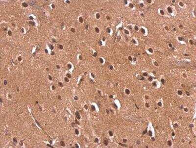 Immunohistochemistry-Paraffin: Monoglyceride Lipase Antibody [NBP2-19380] -  Rat fore brain. Monoglyceride lipase antibody dilution: 1:500. Antigen Retrieval: Trilogy™ (EDTA based, pH 8.0) buffer, 15min. 