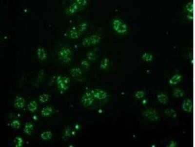 Flow Cytometry: Monoglyceride Lipase Antibody (OTI2B11) - Azide and BSA Free [NBP2-72759] - Staining of COS7 cells transiently transfected by pCMV6-ENTRY.