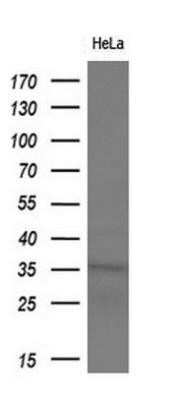 Western Blot: Monoglyceride Lipase Antibody (OTI2B11) - Azide and BSA Free [NBP2-72759] - Analysis of extracts (10ug) from HeLa cell line, dilution(1:200).