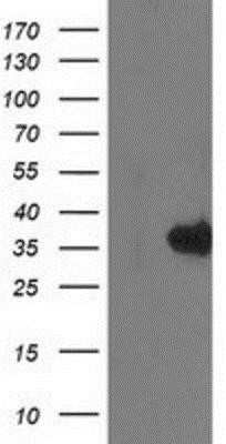 Western Blot: Monoglyceride Lipase Antibody (OTI2B11) - Azide and BSA Free [NBP2-72759] - HEK293T cells were transfected with the pCMV6-ENTRY control (Left lane) or pCMV6-ENTRY Monoglyceride Lipase (Right lane) cDNA for 48 hrs and lysed. Equivalent amounts of cell lysates (5 ug per lane) were separated by SDS-PAGE and immunoblotted with anti-M