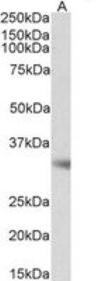 Western Blot Monoglyceride Lipase Antibody